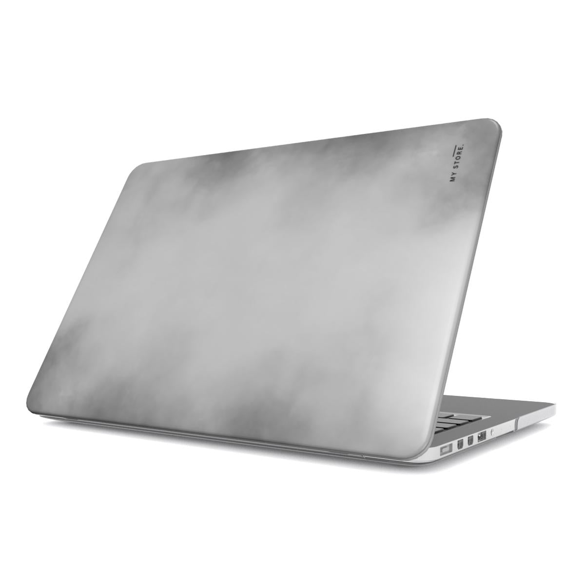X MacBook Case