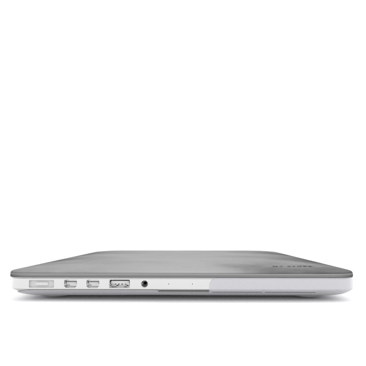 X MacBook Case