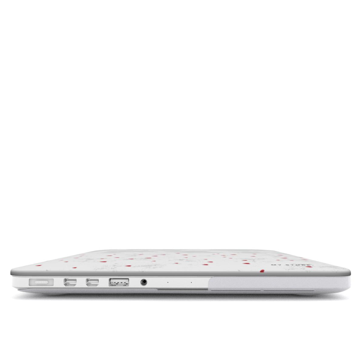AND MacBook Case