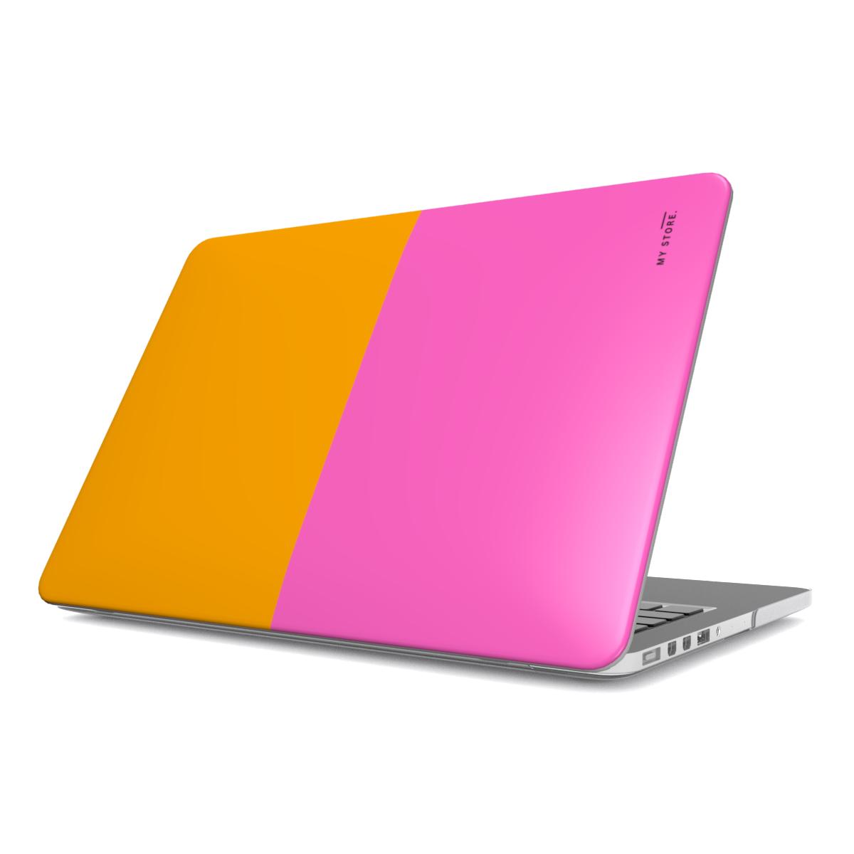 Three MacBook Case