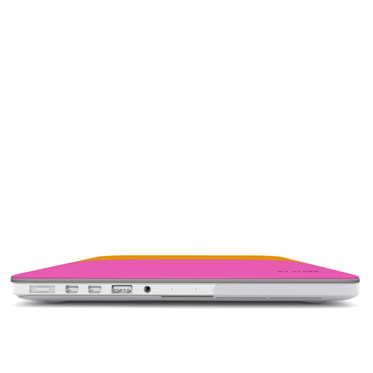 Three MacBook Case