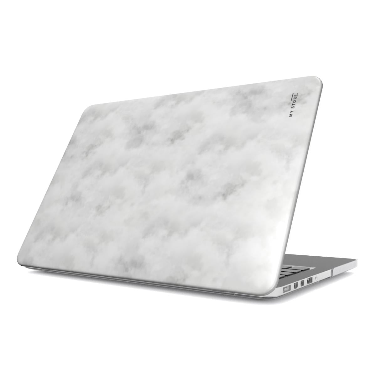 Q MacBook Case