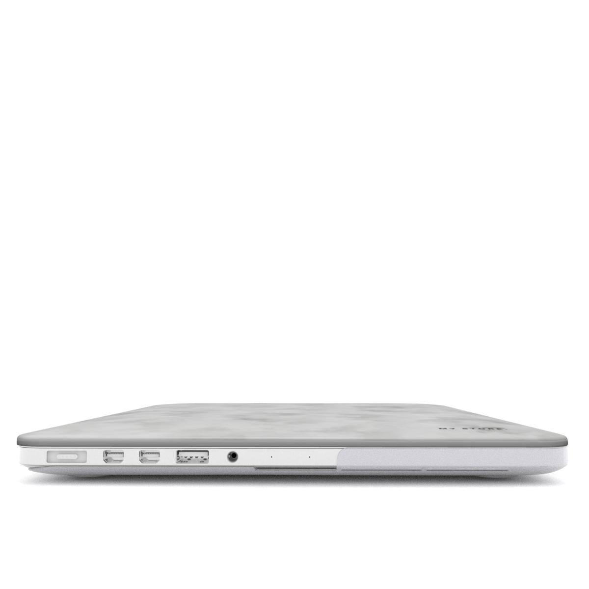 Q MacBook Case