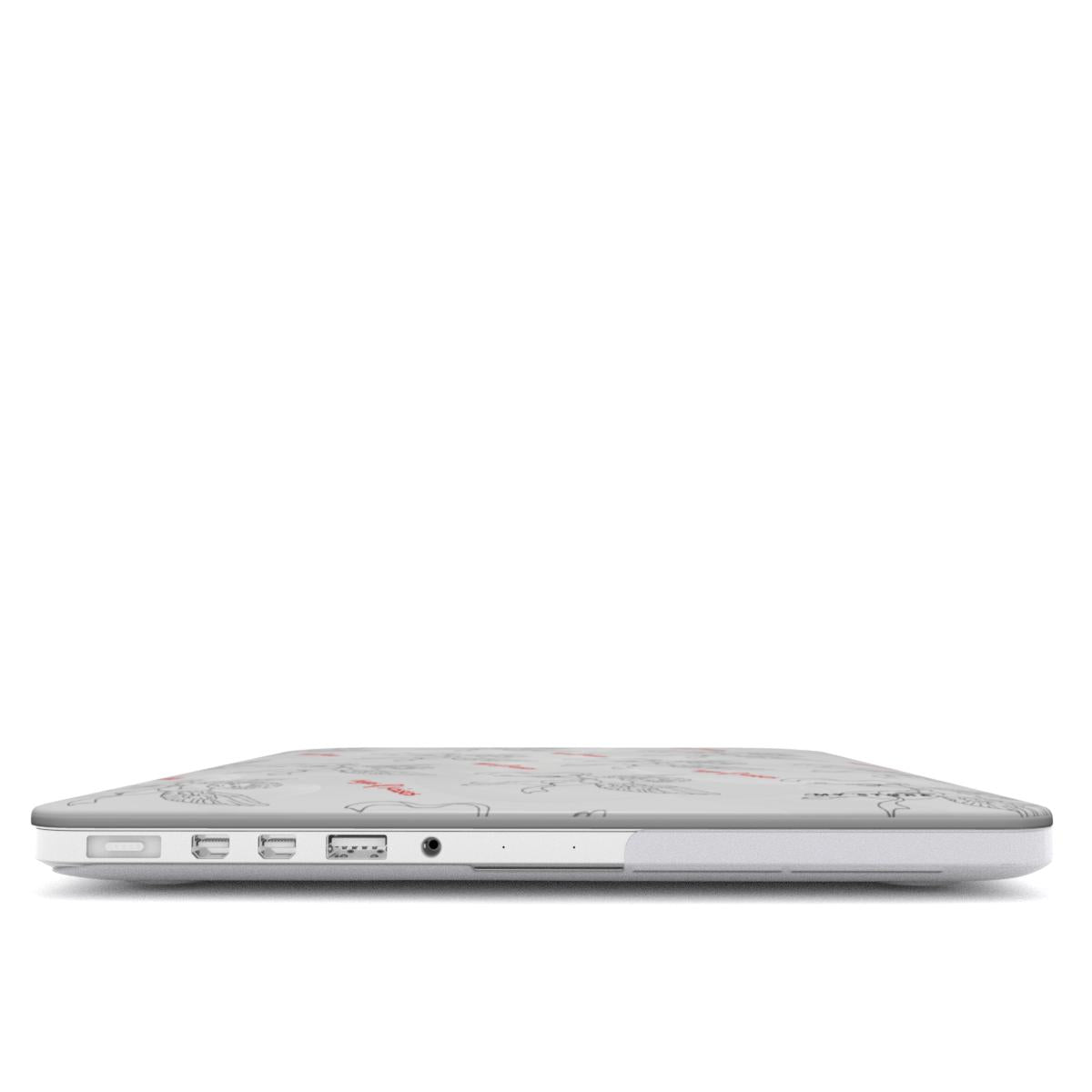 FOREVER MacBook Case